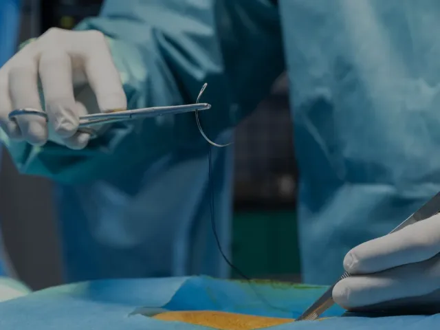 Sutures carried by Impact Medical